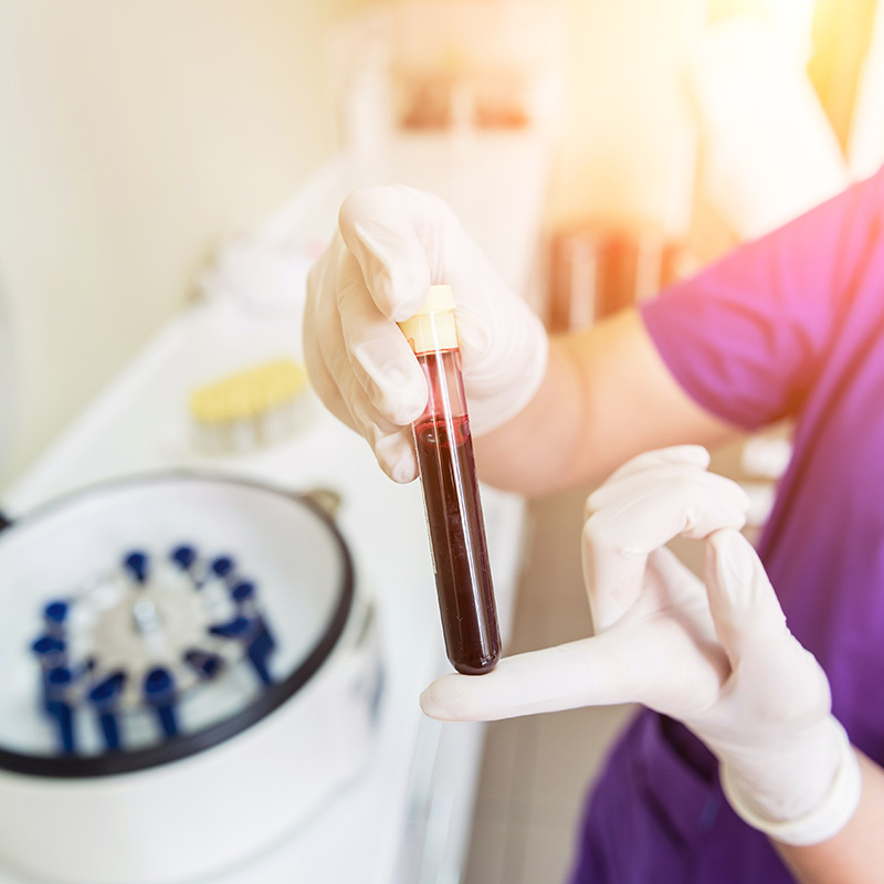 PRP自體血小板血漿注射